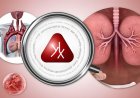 Tips to Reduce the Risks of Sexually Transmitted Diseases.